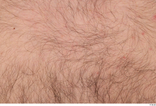 Turgen hairy nude skin 0001.jpg